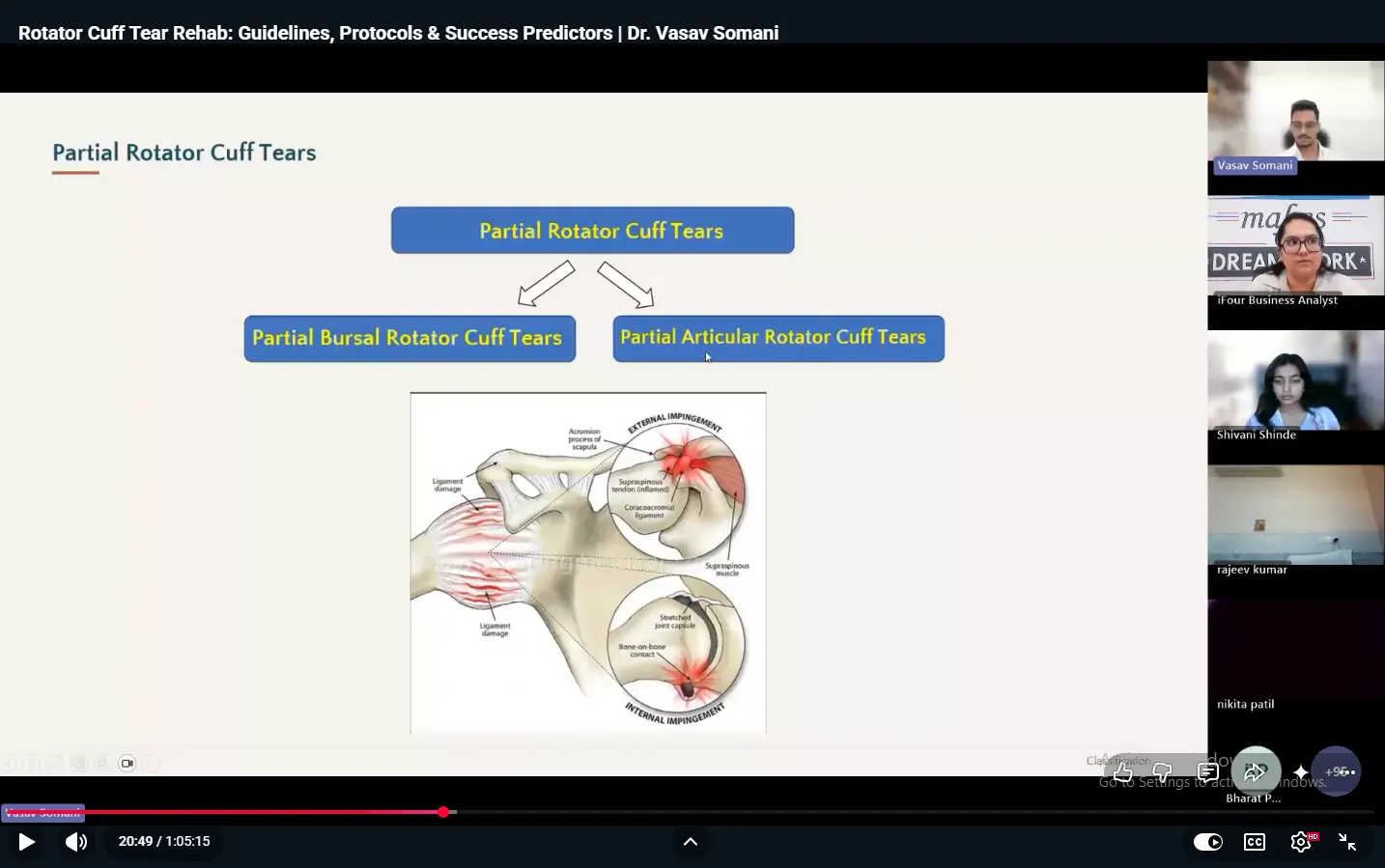 Partial rotator cuff tears slide showing bursal and articular tear types with shoulder impingement diagram